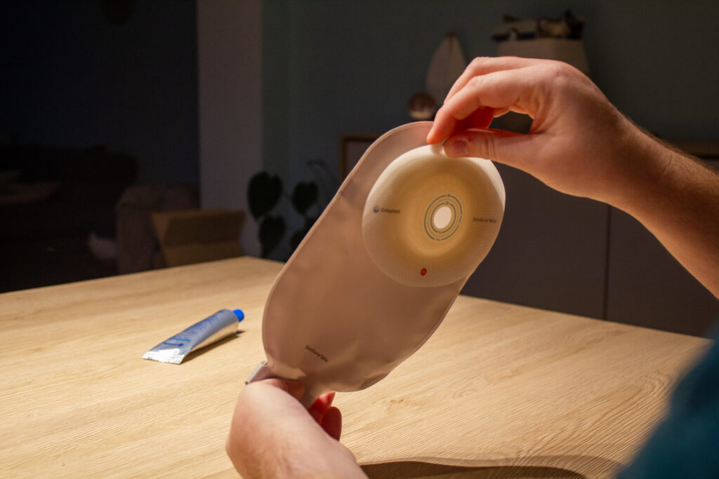 Leven met een stoma: ‘Het heeft mijn leven veranderd’