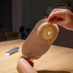 Leven met een stoma: ‘Het heeft mijn leven veranderd’