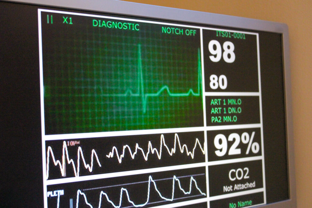 Beslissen over een leven, een zware last voor artsen en families